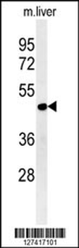 DDI2 Antibody (Center)