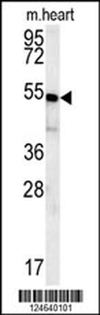 HEY2 Antibody (N-term)