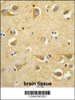 CLTC Antibody (Center)