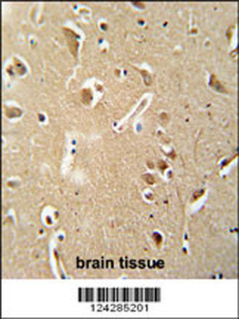 CILP2 Antibody (Center)