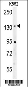CILP2 Antibody (Center)