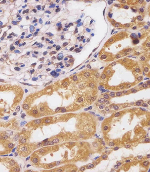 CUX1 Antibody (C-term)