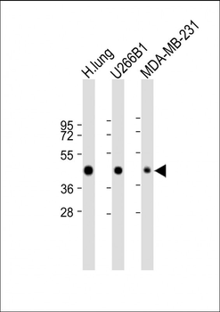 HLA-F Antibody (Center)