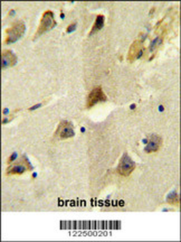 SLC12A5 Antibody (N-term)