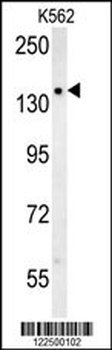 SLC12A5 Antibody (N-term)
