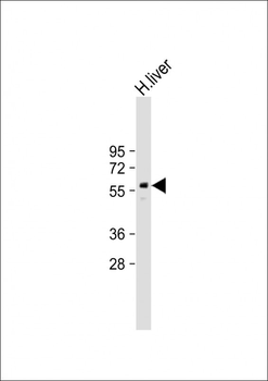 PPARG Antibody (N-term)