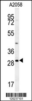 RIMS4 Antibody (N-term)