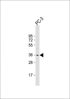 OTUD6B Antibody (C-term)