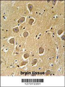 AQP11 Antibody (C-term)