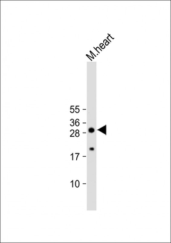 AQP11 Antibody (C-term)