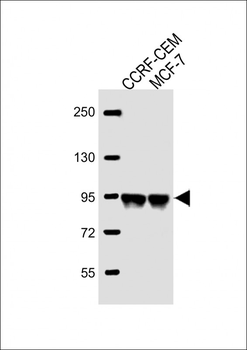 AFTPH Antibody (C-term)