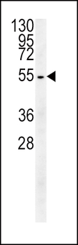 TUBB3 Antibody (N-term)