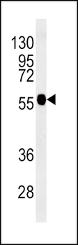 TUBB3 Antibody (N-term)