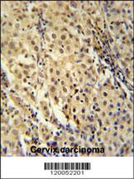 FOXC2 Antibody (Center S174)