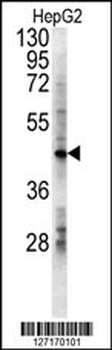 LDHD Antibody (N-term)