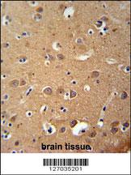 ZDHC2 Antibody (N-term)