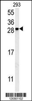 KCT2 Antibody (Center)