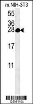 KCT2 Antibody (Center)