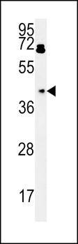 BDHA1 Antibody (Center)