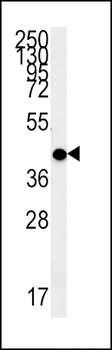 MC2R Antibody (C-term)