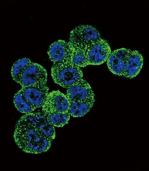 ADH1C Antibody (Center)