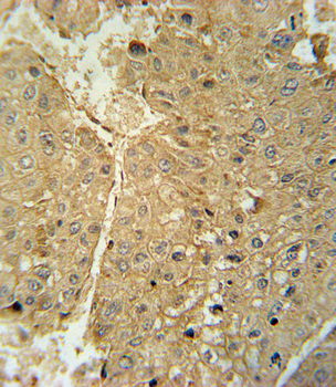 ADH1C Antibody (Center)