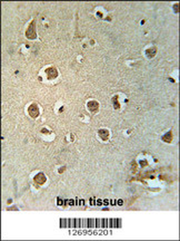 MTCH2 Antibody (N-term)