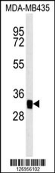 MTCH2 Antibody (N-term)