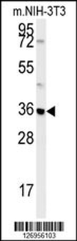 MTCH2 Antibody (N-term)