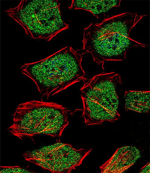 NR3C1 Antibody (Center)