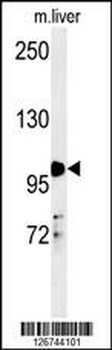 NR3C1 Antibody (Center)