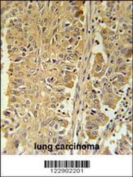 PGD Antibody (Center)