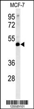 LSP1 Antibody (Center)