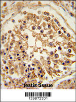 SHCBP1 Antibody (C-term)