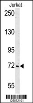 SHCBP1 Antibody (C-term)