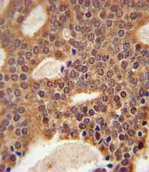 DCLRE1B Antibody (Center)