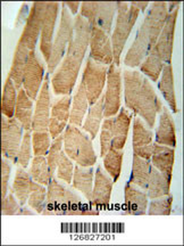 CRLS1 Antibody (C-term)
