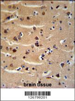 AXIN2 Antibody (C-term)