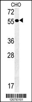 AMY2A Antibody (C-term)