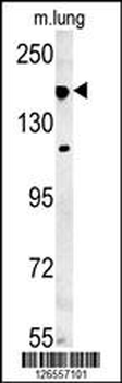IFT172 Antibody (N-term)