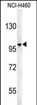 ST18 Antibody (N-term)