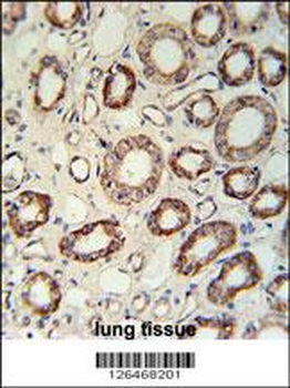 C102B Antibody (C-term)