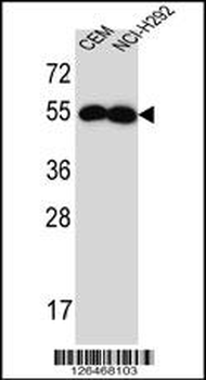 C102B Antibody (C-term)