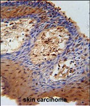 DHRS2 Antibody (C-term)