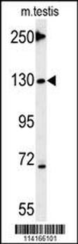 Tnks 2 Antibody (C-term)