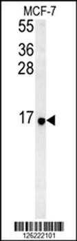 RPS26 Antibody (N-term)