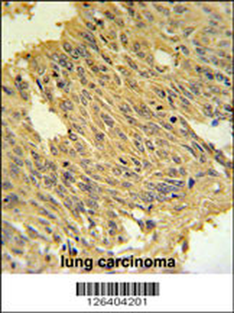 MFRN2 Antibody (N-term)