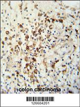 HAUS5 Antibody (N-term)