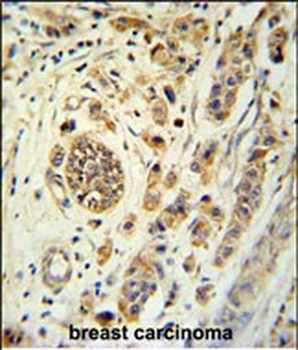 FBXL15 Antibody (C-term)