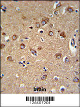 PIANP Antibody (N-term)